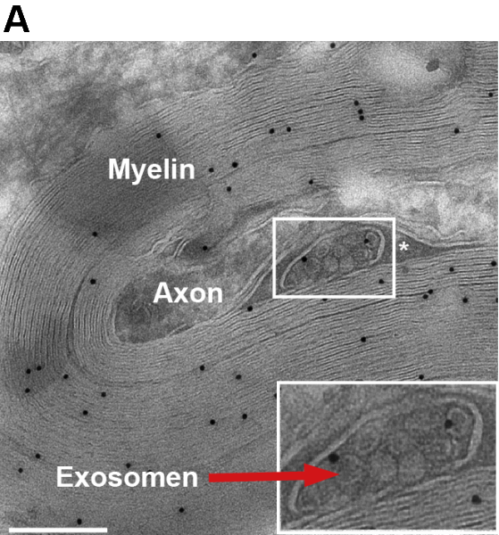 Exosomes (red arrow) are small vesicles that contain proteins and nucleic acids