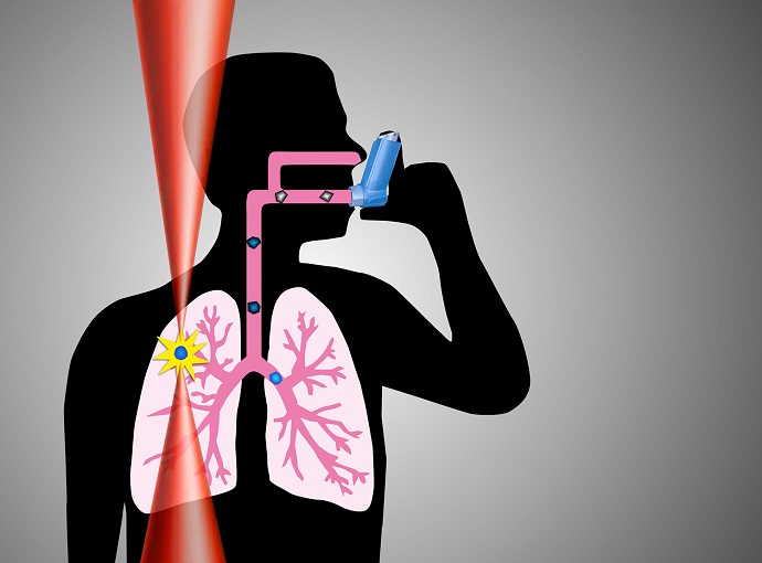Lasers could improve the treatment of asthma
