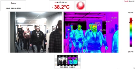 Skin Temperature Measurement System