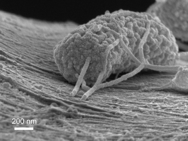 The tubular growth depicted here is a type of microbe that can produce electricity