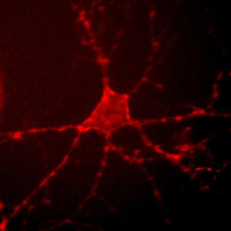 Archer1 fluorescence in a cultured rat hippocampal neuron