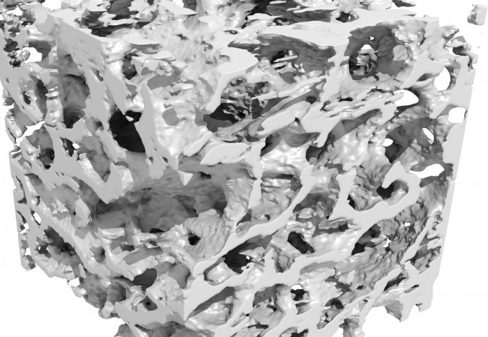 New imaging technique could help with early diagnosis of bone problems such as osteoporosis